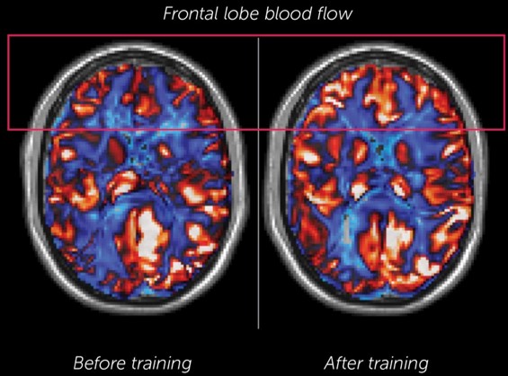 Brain scan showing brain blood flow (Chapman, Aslan et al., 2015, Cerebral Cortex).