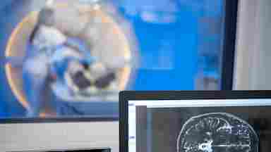 Brain scan visualized on a computer screen while a female doctor slides a patient into the MRI scanner.