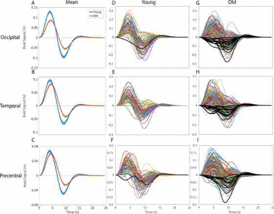Figure 2. Hemodynamic Response Functions across (blue) young and (orange) healthy older adults in A) the occipital region of interest in response to a checkerboard stimulus for 34 ms, B) the temporal region of interest in response to 300 ms binaural tone at 1200 Hz, and C) the LH precentral region of interest due to right-index finger button-press response with the (solid line).