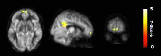 Enhancing Innovative Cognitive Brain Networks (Fig 2)
