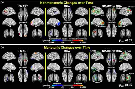 Colormaps for nonmonotonic (a) and monotonic (b) within‐ and between‐group contrasts for changes in cortical thickness over time (p vertex < .05, p cluster < .05). SMART, strategic memory advanced reasoning training; BHW, brain health workshop; L, left; R, right; DLPFC, dorsolateral prefrontal cortex; SCG, subcentral gyrus; DPFC, dorsal prefrontal cortex; AMPFC, anterior medial prefrontal cortex; PRCG, precentral gyrus; PCG, postcentral gyrus; MT+, middle temporal complex; LG, lingual gyrus; APFC, anterior prefrontal cortex; OCPL, occipito‐parietal lobe