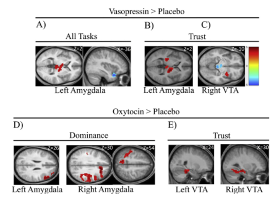 Differences in connectivity patterns for amygdala and VTA seed regions when contrasting OT or AVP treatments versus placebo for various task conditions. A) Increasing (red) and decreasing (blue) connectivity with the left amygdala during AVP sessions regardless of rating type. B) Increasing and decreasing connectivity with the left amygdala for AVP treatment during trust evaluations. C) Increasing and decreasing connectivity with the right VTA for AVP treatment during trust evaluations. D) Increasing correlations between amygdala connectivity and dominance ratings when comparing OT treatment versus placebo. E) Increasing correlations between VTA connectivity and trust ratings when comparing OT treatment versus placebo. Results are shown as t-score values for voxels significant at p < .001 uncorrected and cluster size corrected for p < .05 in AFNI’s 3dClustSim.