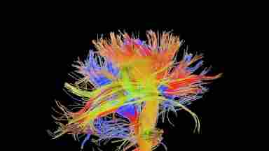 A 3D rendition of nervous pathways in the brain highlighted in multiple colors.