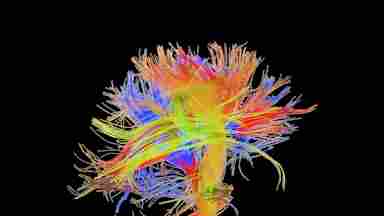 A 3D rendition of nervous pathways in the brain highlighted in multiple colors.