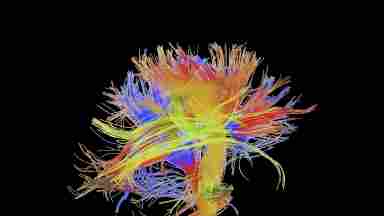 Multicolored fibers depict the complex inner structure of the human brain.