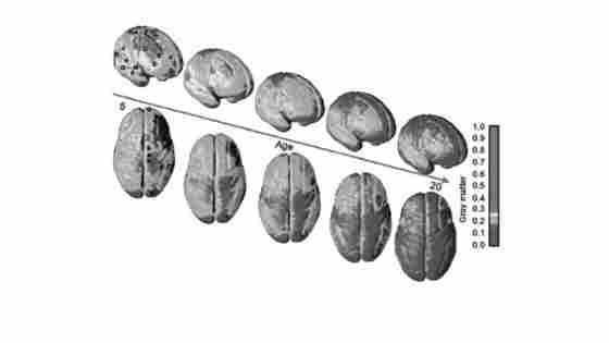Figure 1.1. A longitudinal study demonstrating neuromaturational processes from 5 to 20 years of age. (From Gogtay et al., 2004 © National Academy of Sciences, USA.) A black and white version of this figure will appear in some formats. For the color version, please refer to the plate section.