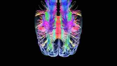 A colorful, top-down scan of a human brain illuminated in several colors against a black background.
