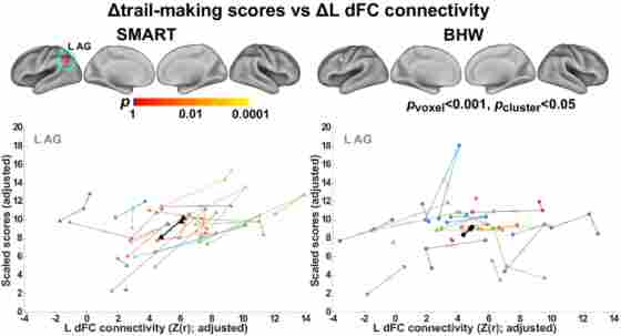 Two graphs and brain scans showing associations between temporal changes in the brain during a study on neuroplasticity.