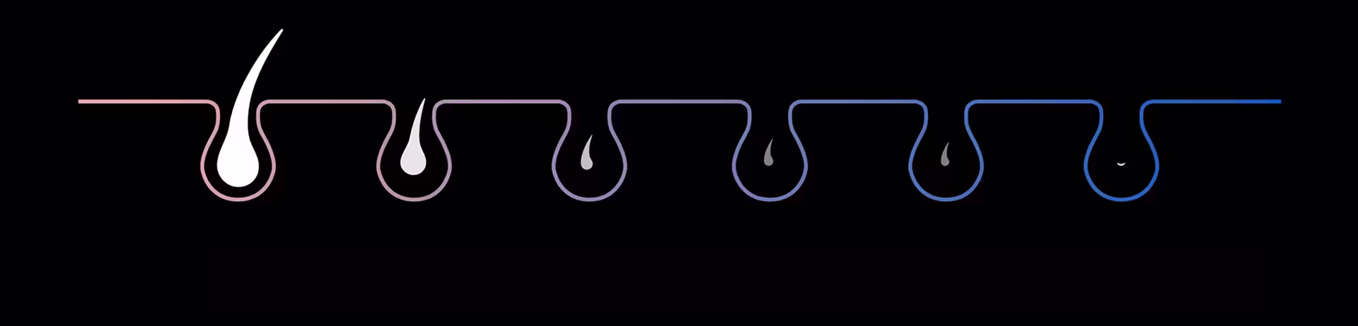 Grafica che mostra i peli sulla pelle tra la prima e la sesta sessione, illustrando una visibile riduzione della ricrescita. Grafica che mostra i peli sulla pelle tra la prima e la sesta sessione, illustrando una visibile riduzione della ricrescita.