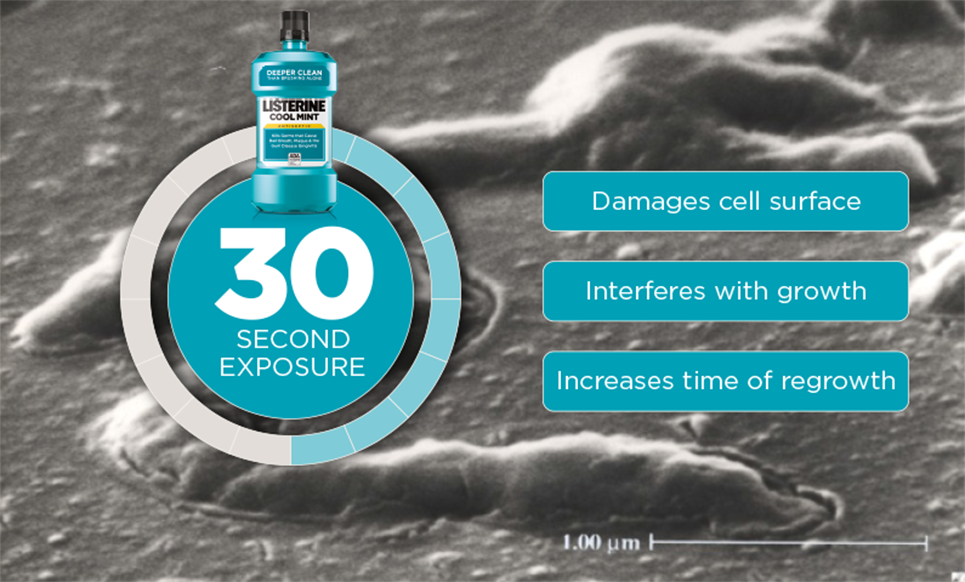 Benefits of LISTERINE® Mouthwash