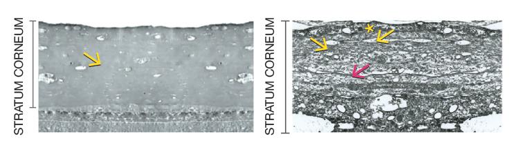 Active Glycerin and stratum corneum