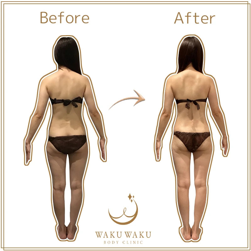 t-30b(後ろ) 石川CKハイパー