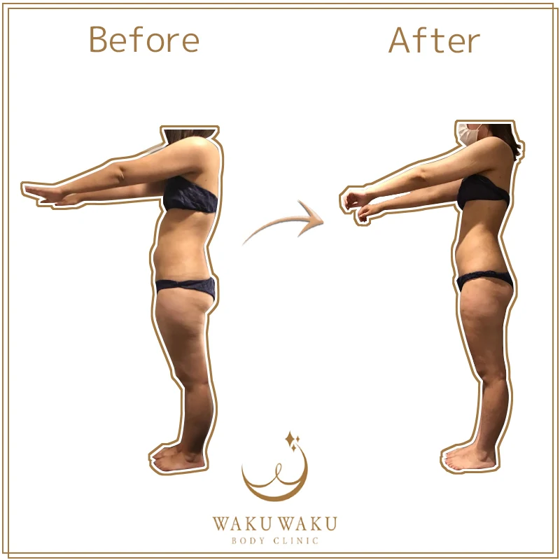 c-03野呂-ハイパー横 c-03野呂-ハイパー横