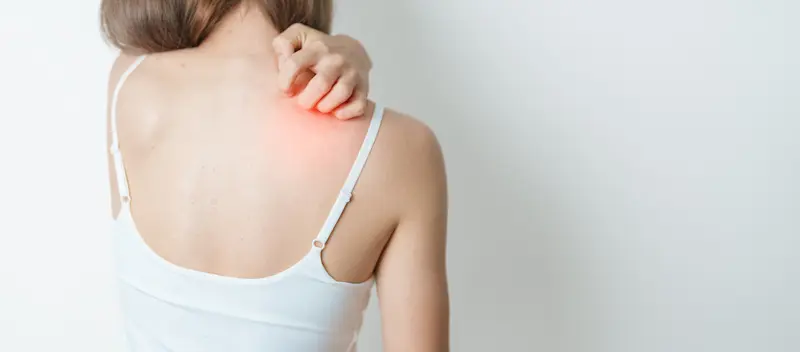 かゆみ2 かゆみ2