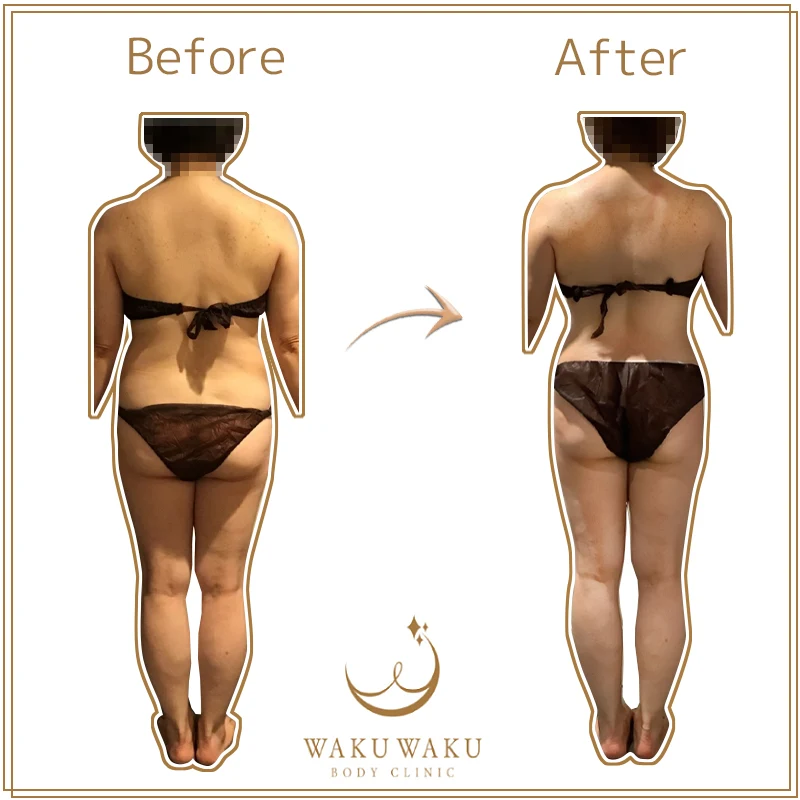 c-37a 浅岡CKハイパー(モザイク希望) 後