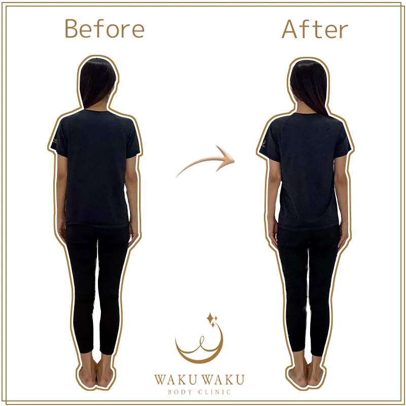 藤久保ビフォーアフター