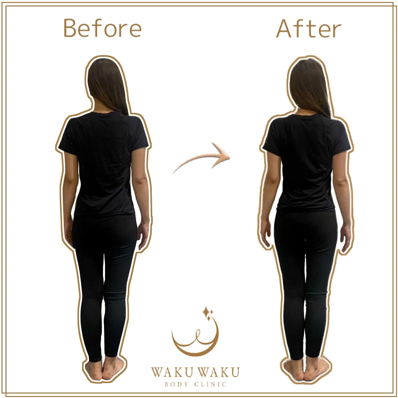 八神ビフォーアフター1 八神ビフォーアフター1