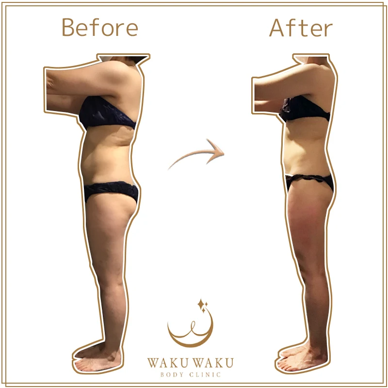 c-26aハイパー原田 横