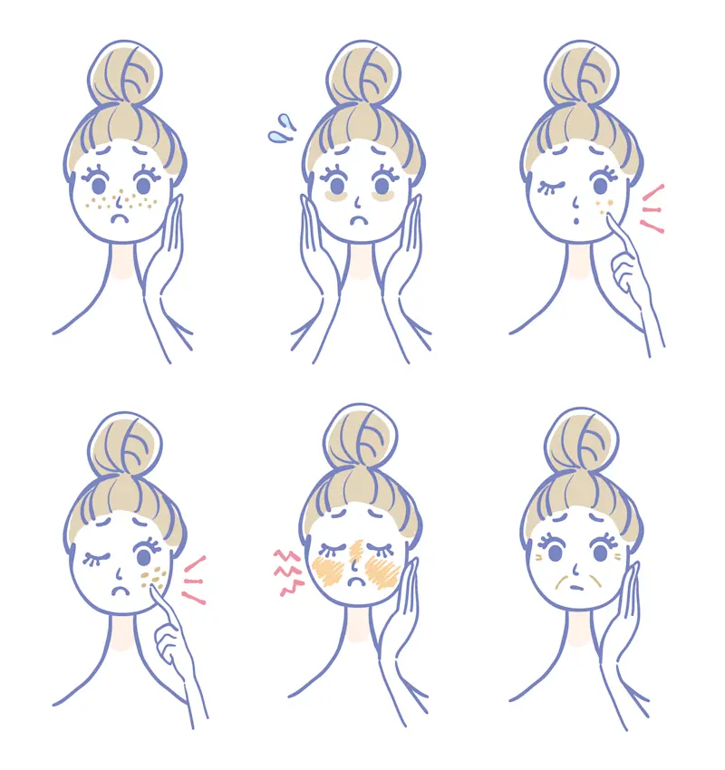 肌トラブル 種類 イラスト 肌トラブル 種類 イラスト