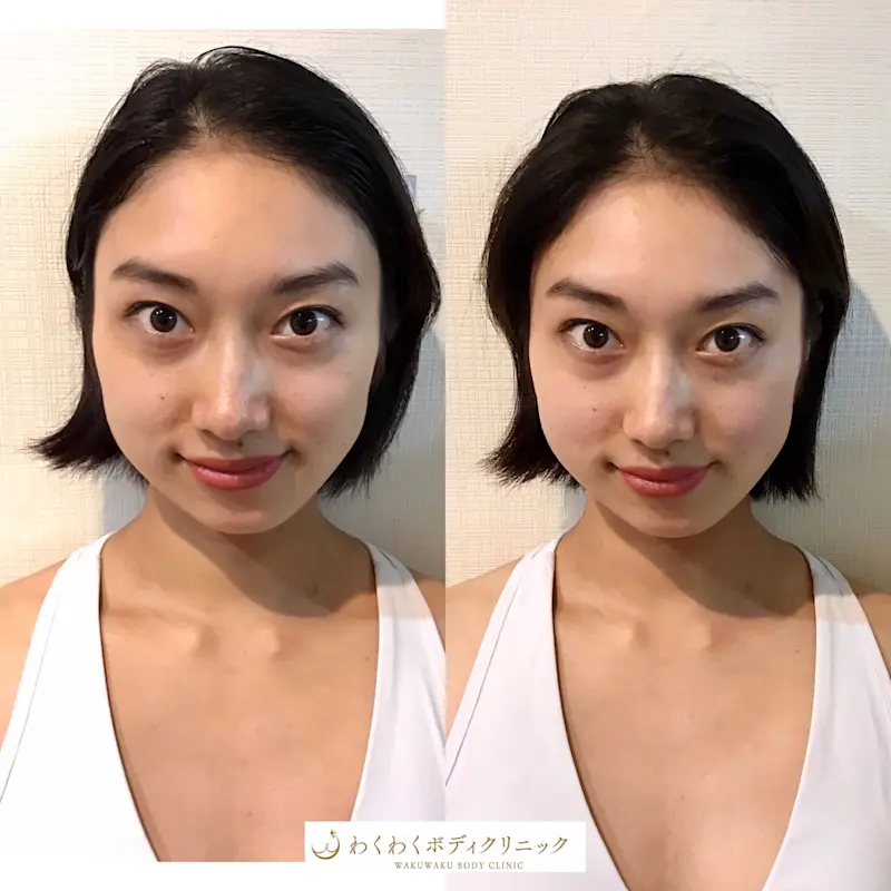 iOS の画像 (20) iOS の画像 (20)