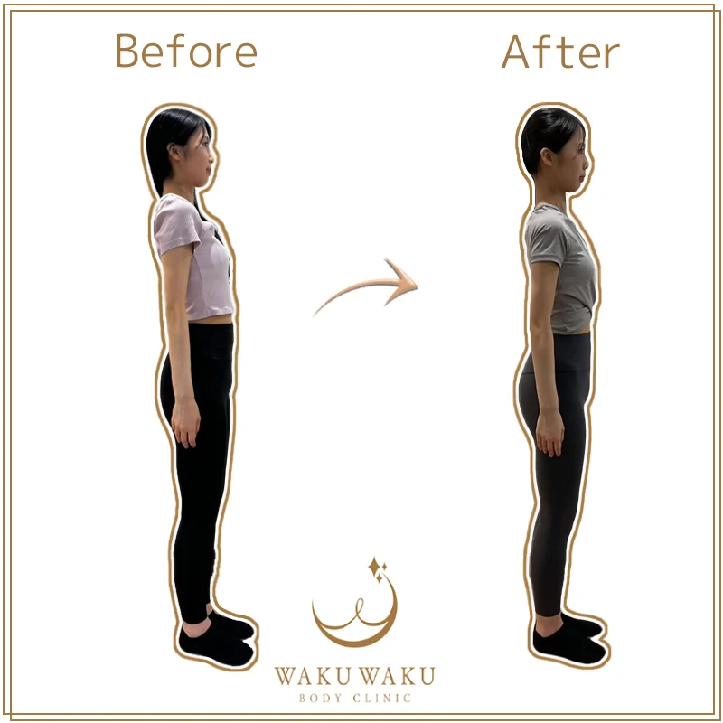 富山-横-山-16@akane tsukashima