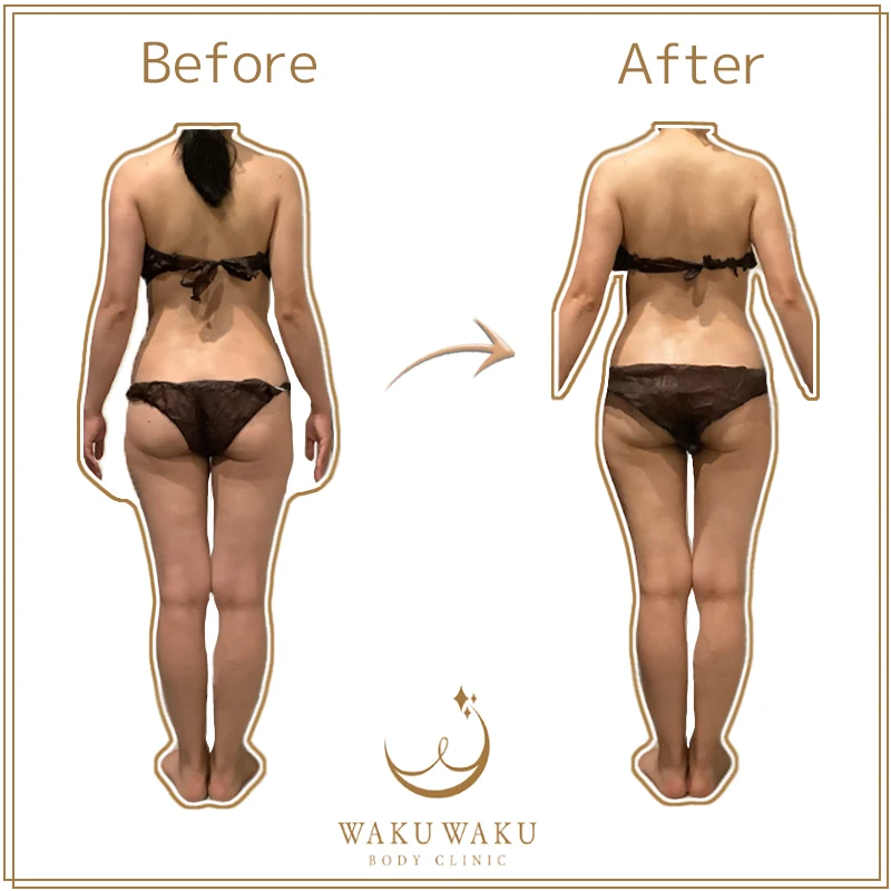 t-40b 名前間違いだけど同一人物 後ろ