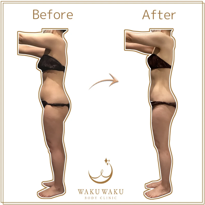 t-18a蝦名ハイパー 横