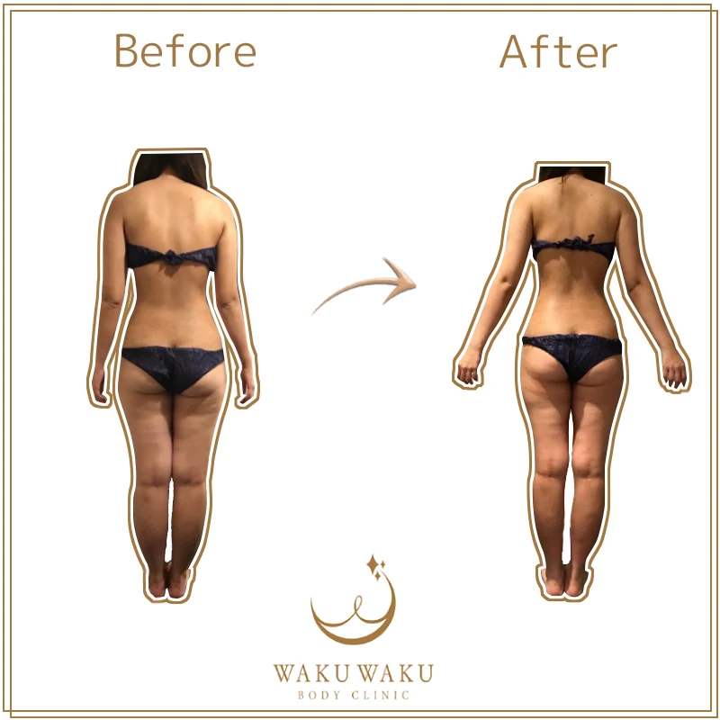 c-03野呂-ハイパー (2) c-03野呂-ハイパー (2)