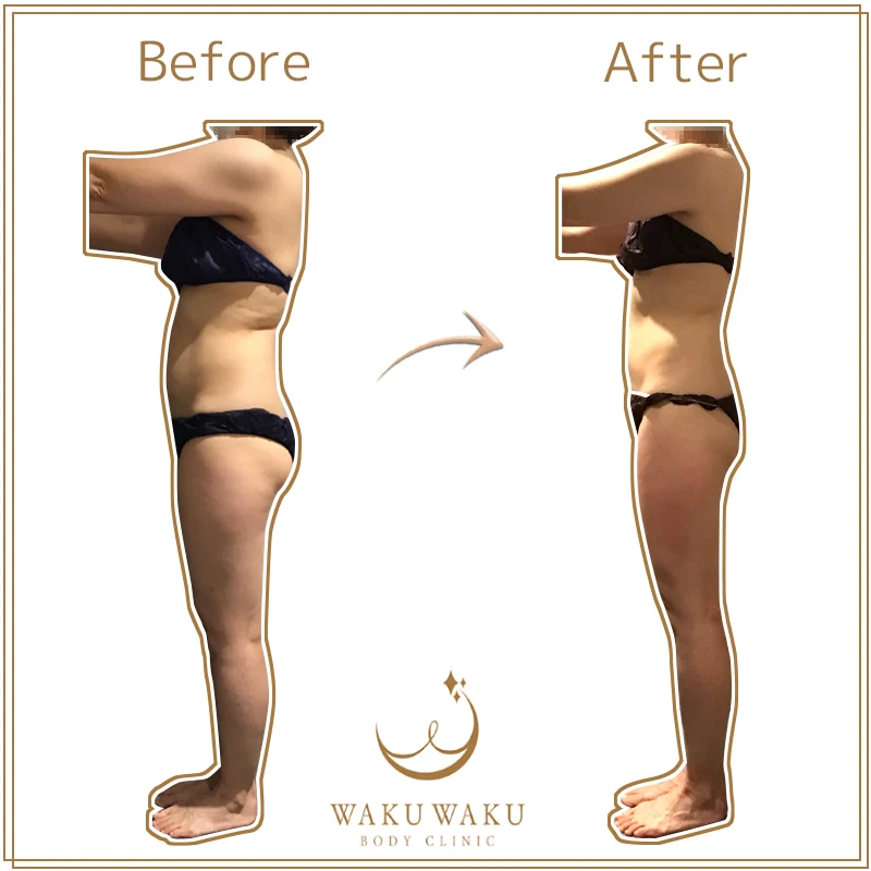 c-30蝦名ハイパー(モザイク希望)