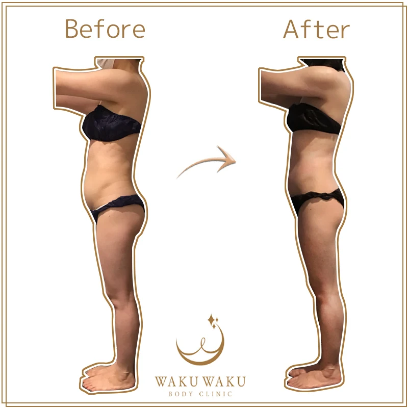 c-22a原田ハイパー 横向き (2) c-22a原田ハイパー 横向き (2)