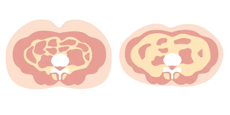 内臓脂肪 内臓脂肪