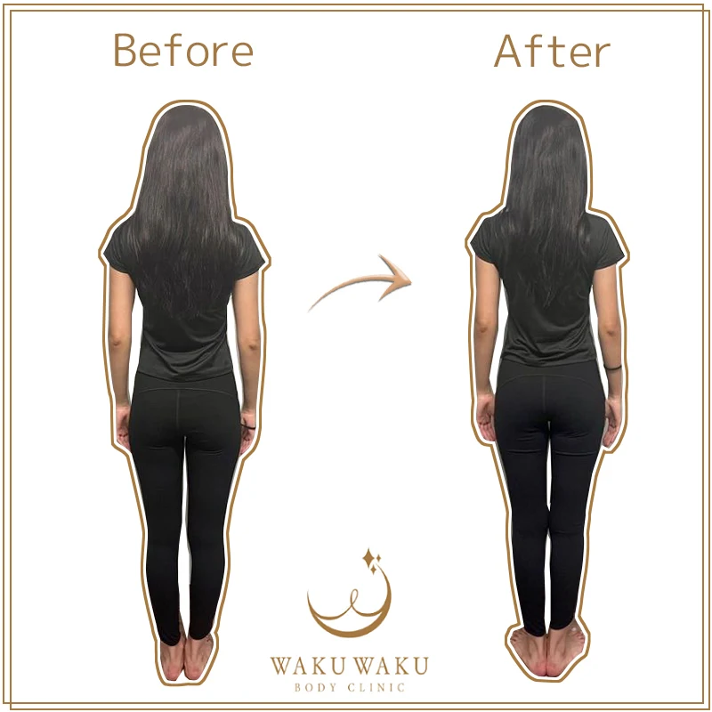 清水ビフォーアフター (1) 清水ビフォーアフター (1)