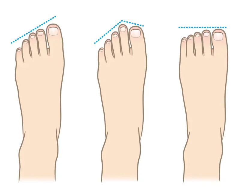 足の形