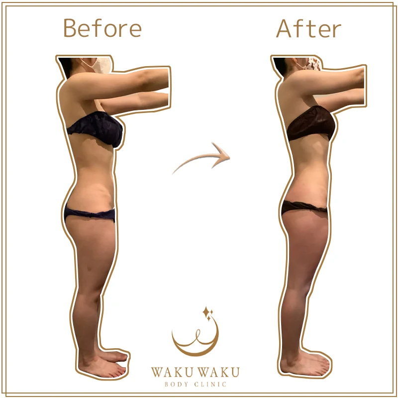 m-17b鹿島ハイパー 横