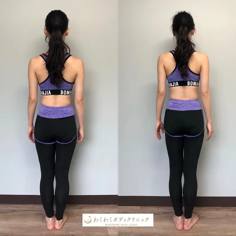 S 36069392 S 36069392