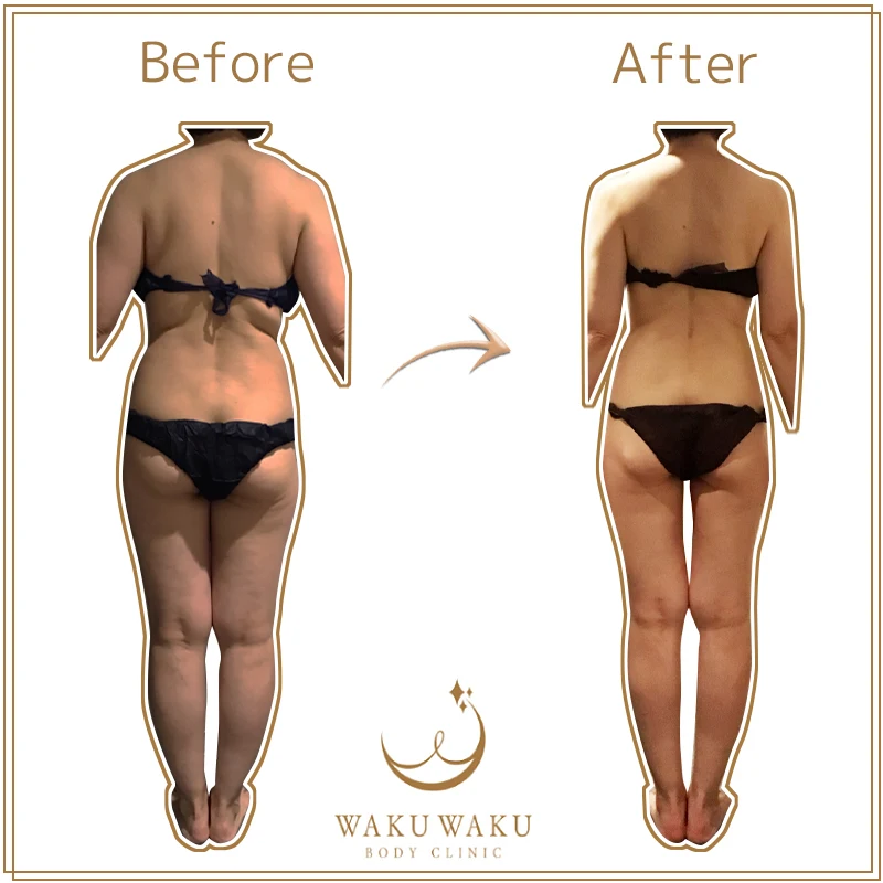 c-26aハイパー原田 後ろ (1)