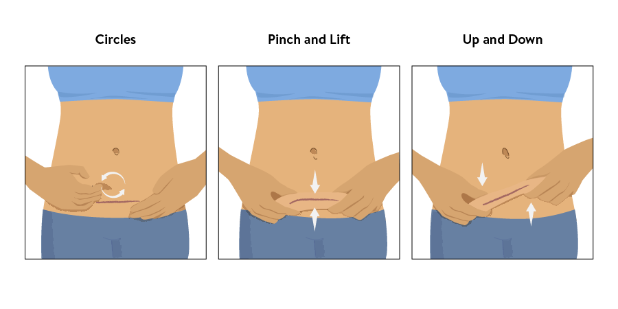 How to Massage C Section Scar: Effective Tips for Faster Healing