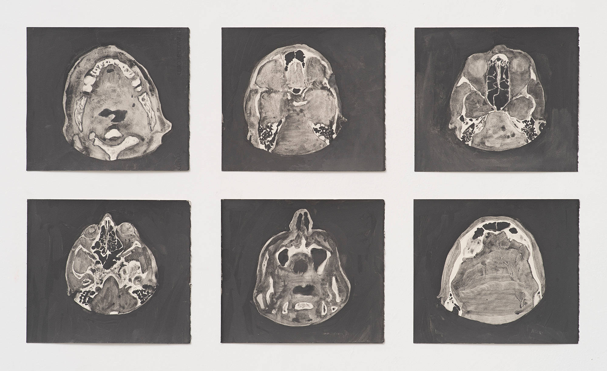 Six liquid graphite on paper drawings, laid in three columns and two rows, depict MRI scans of the Artist's sinus cavity.