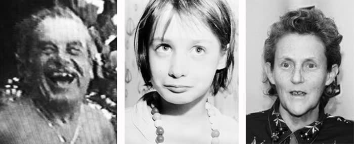 A trio of black and white portrait photographs of three people. The person in the center resembles a young child. The people on the left and right appear older. 