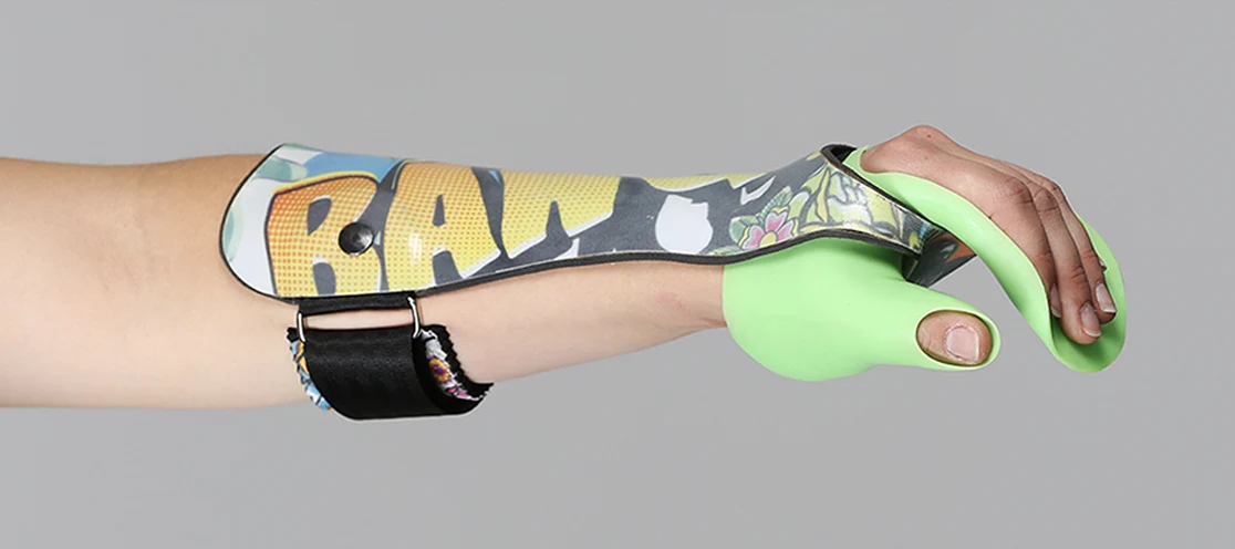 Hand orthoses - hero image