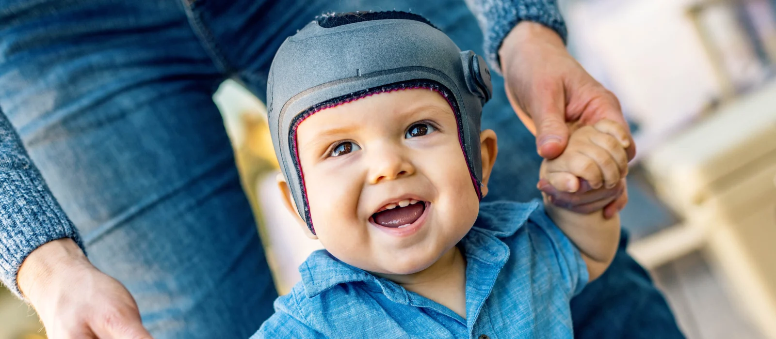 Child in a cranial helmet