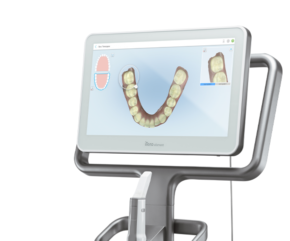 Intraoral scanner solutions - iTero