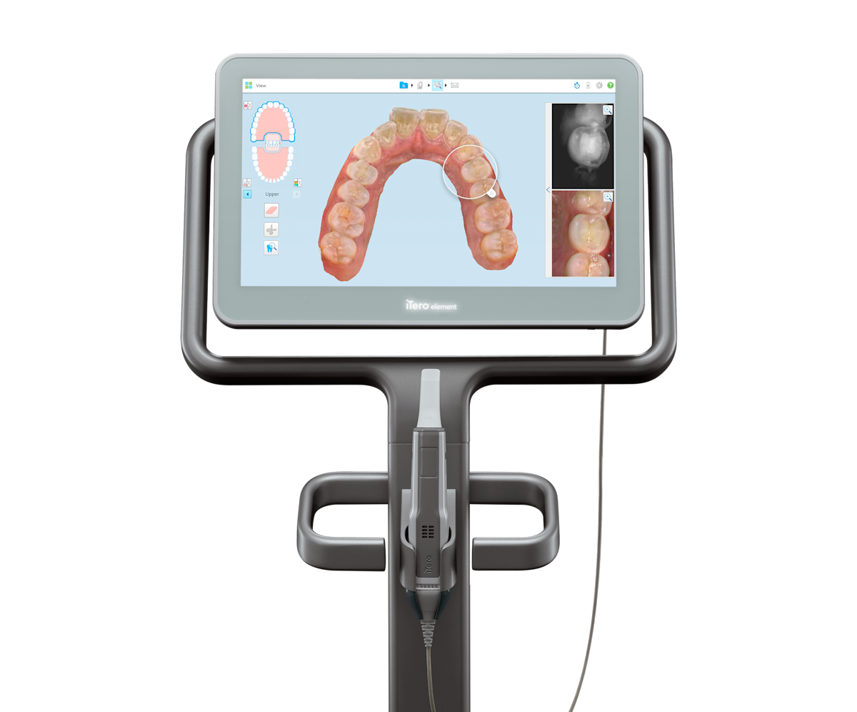 Purchasing solutions of intraoral scanners iTero