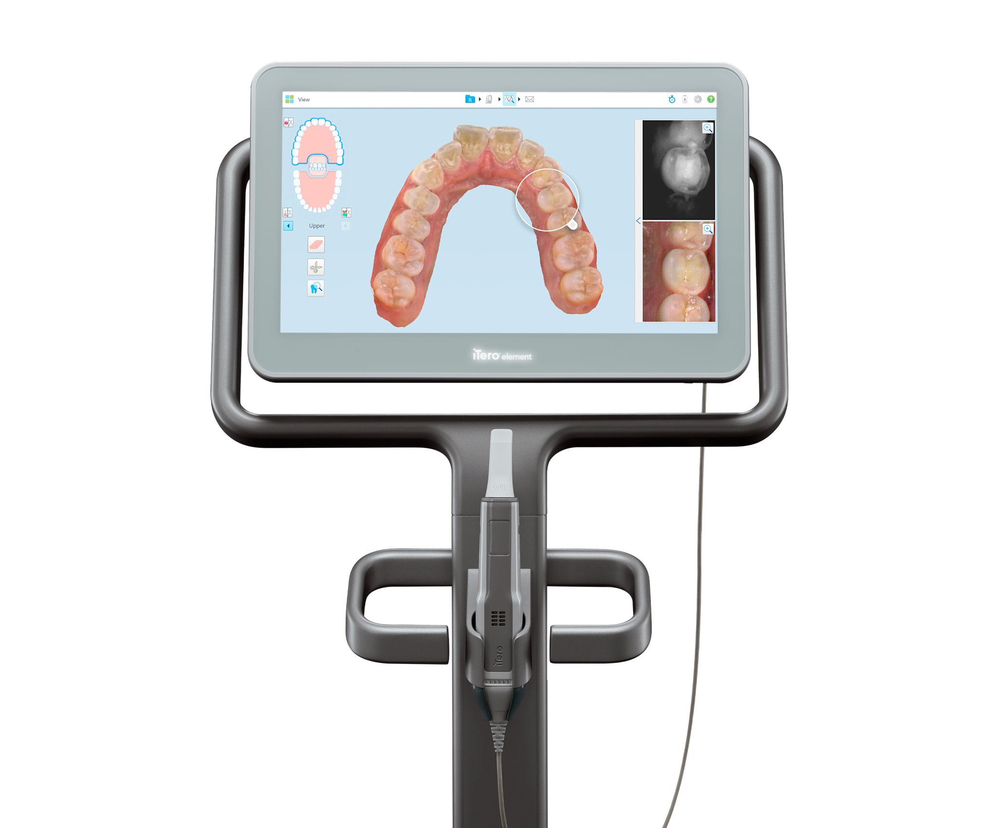 Purchasing solutions of intraoral scanners iTero