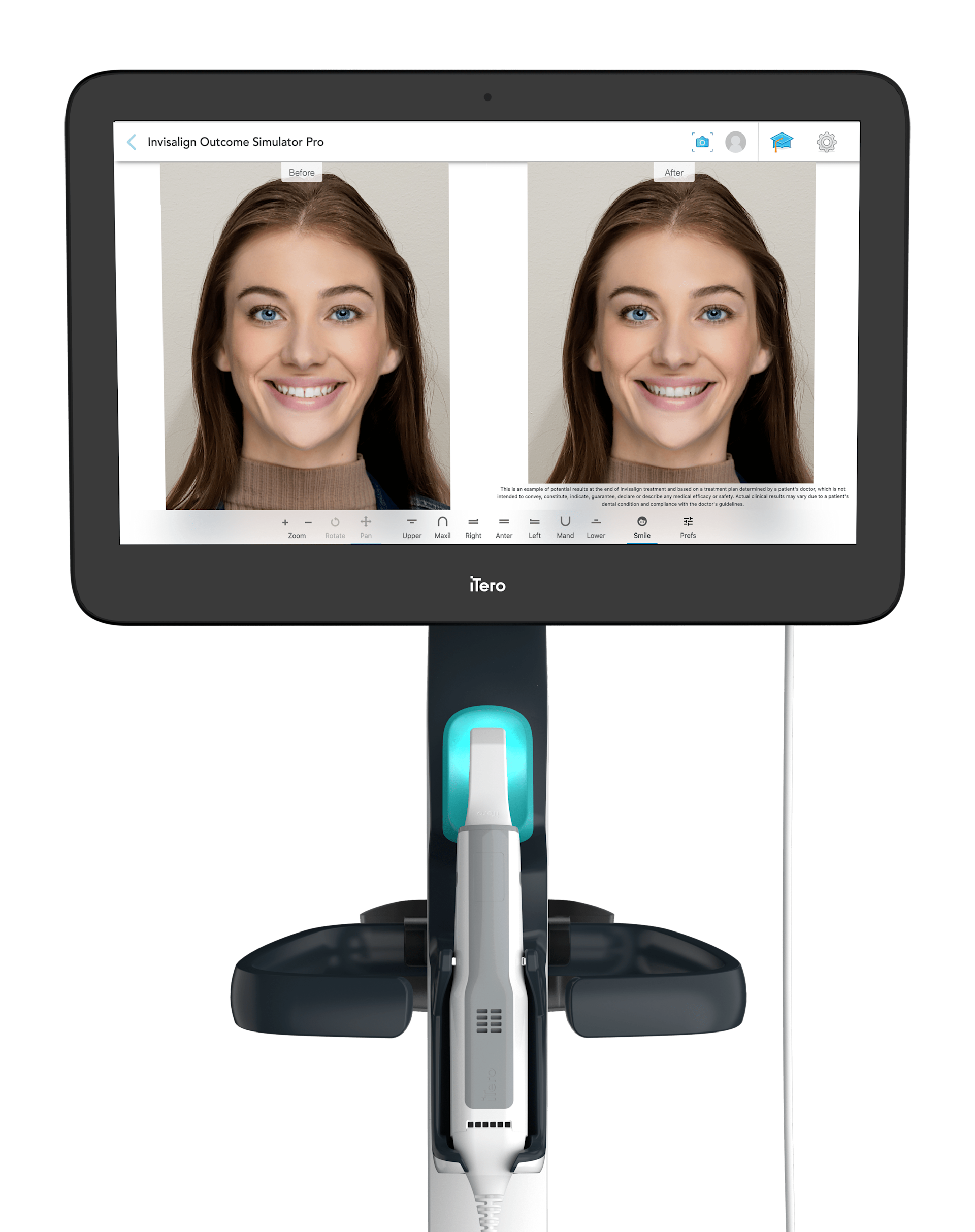 your patient experience with the power of smile visualisation