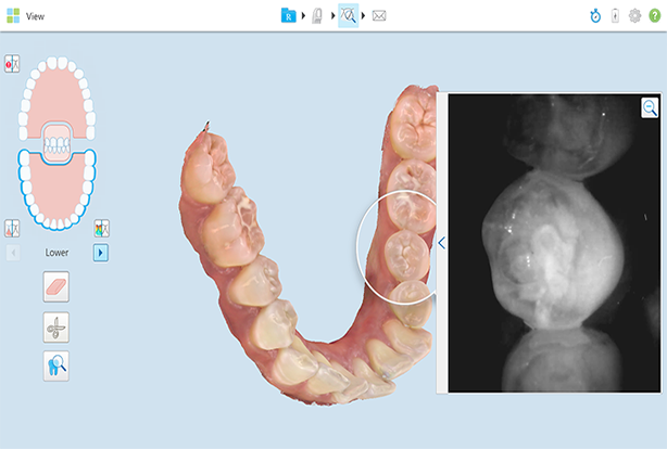 Dental imaging - iTero solutions