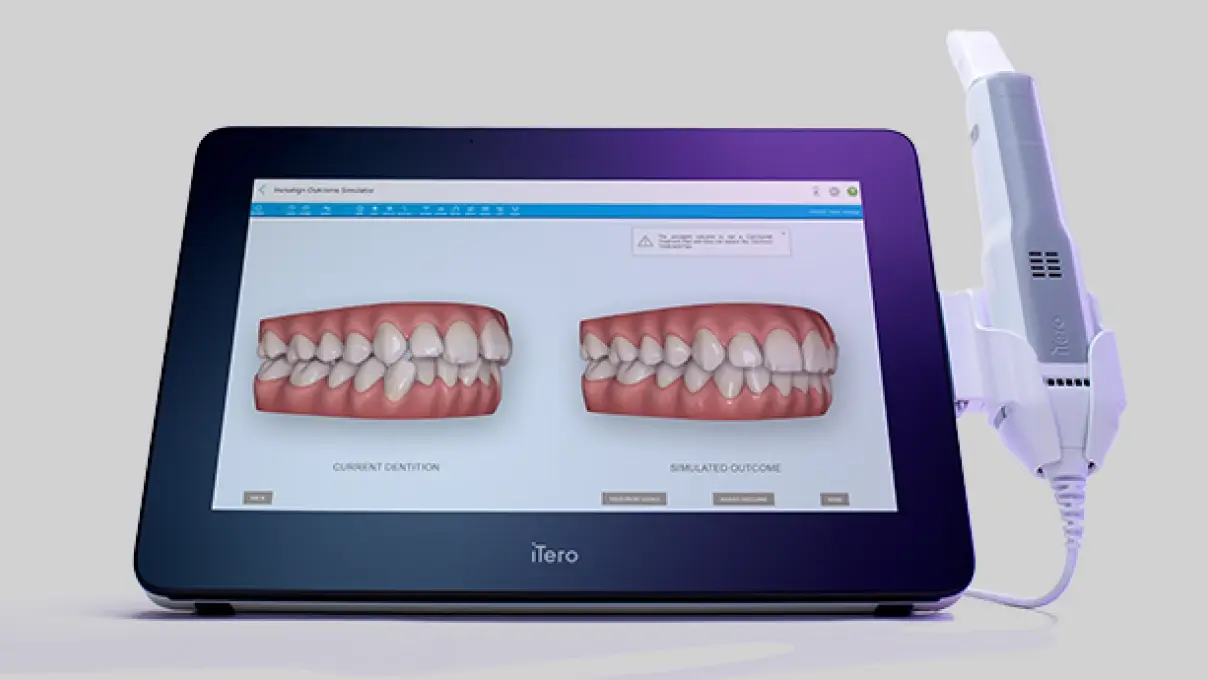 iTero Lumina™ intraoral scanner iTero