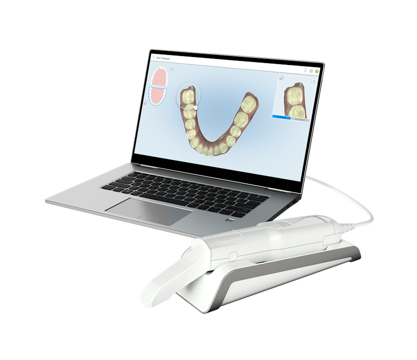 Element Flex Scanner iTero