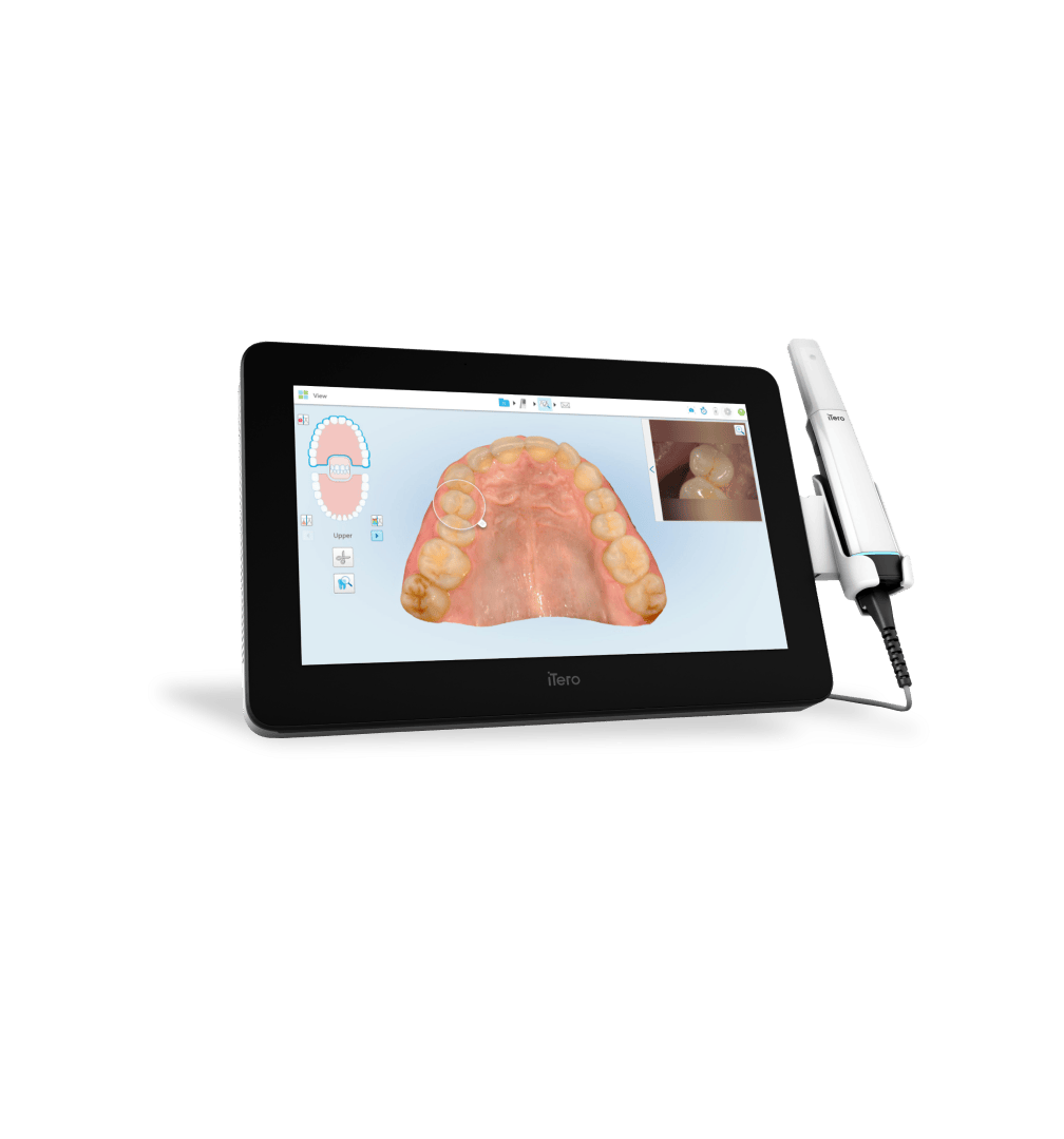 intraoral-scanners-itero