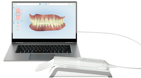 Intraoral scanners | iTero